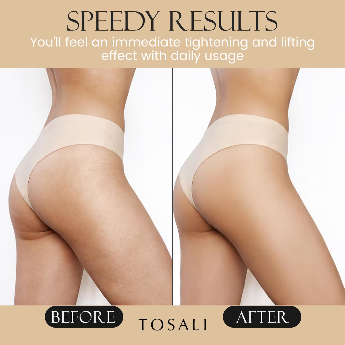 Buttocks Gel